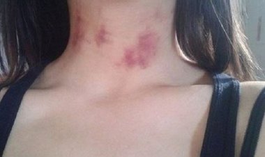 تعرف على سبب البقع الحمراء التي تظهر مباشرة ما بعد العلاقة بين الرجل و المرأة